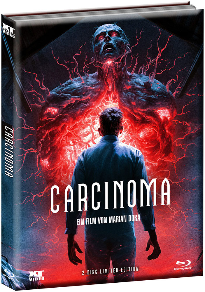 CARCINOMA (Blu-Ray+DVD) - Cover 1 - Mediabook (Wattiert) - Limited 500 Edition - Uncut