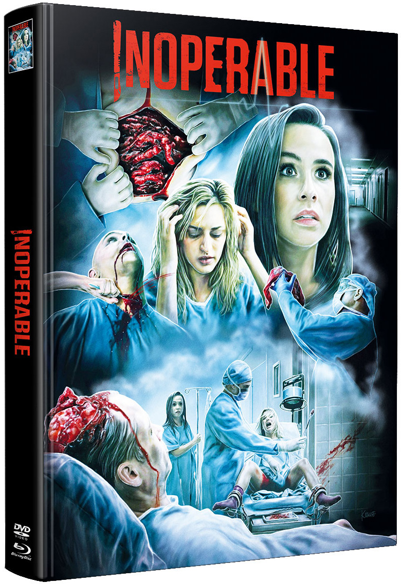 INOPERABLE (Blu-Ray) (2Discs) - Mediabook (Wattiert) - Limited 150 Edition