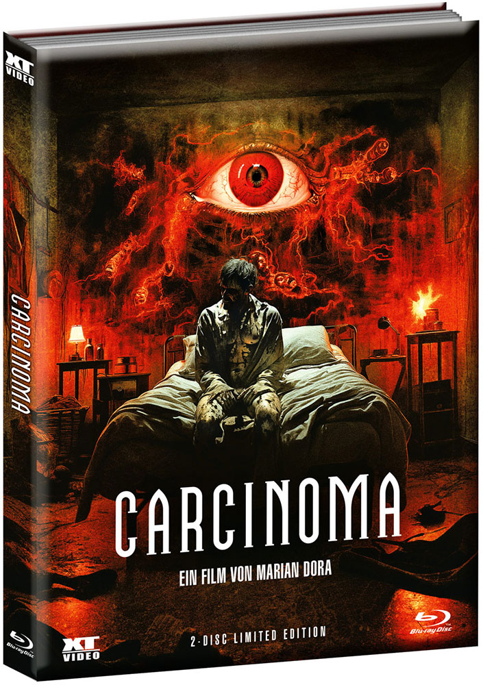 CARCINOMA (Blu-Ray+DVD) - Cover 2 - Mediabook (Wattiert) - Limited 500 Edition - Uncut